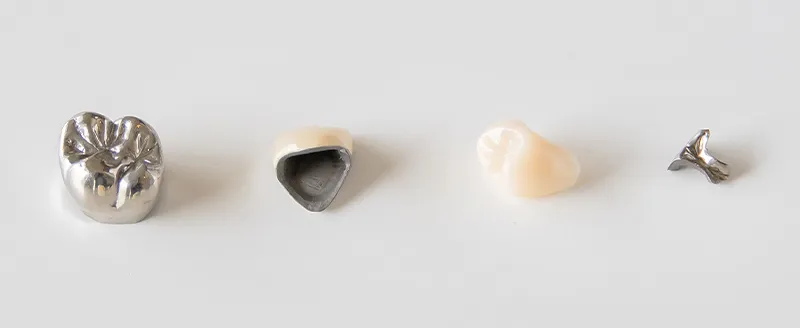 保険の詰め物・被せ物